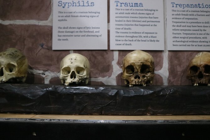 Admission Ticket to Sick To Death in Chester - When to visit and how to plan the stop